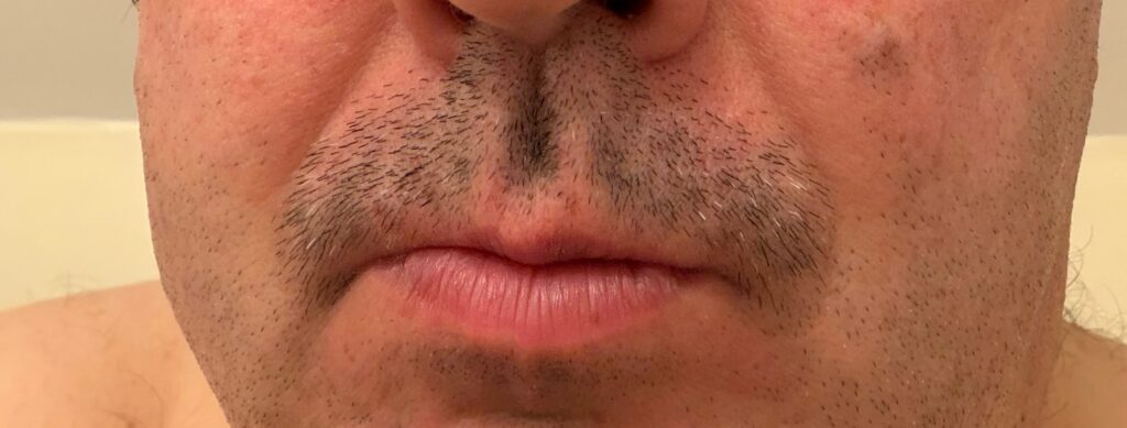 Closeup photo of my upper lip showing the starting stubble of a moustache aka a "mo" for Movember